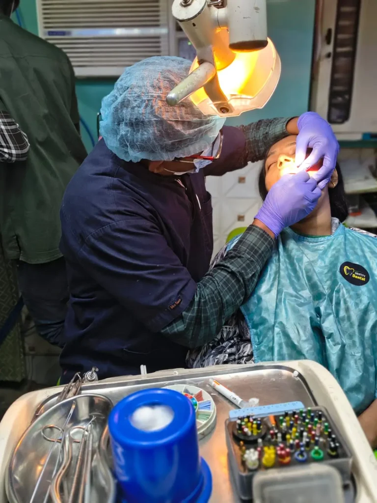 Root Canal Treatment